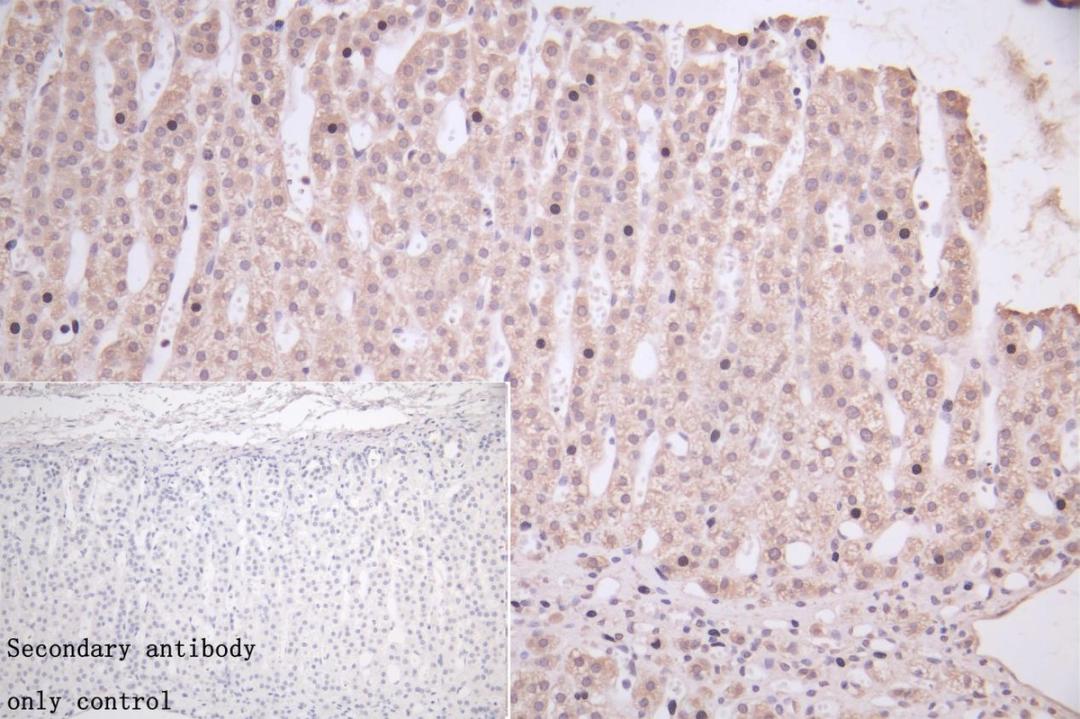 IHC image of CSB-PA011018LA01HU diluted at 1:50 and staining in paraffin-embedded human adrenal gland tissue performed on a Leica BondTM system. After dewaxing and hydration, antigen retrieval was mediated by high pressure in a citrate buffer (pH 6.0). Section was blocked with 10% normal goat serum 30min at RT. Then primary antibody (1% BSA) was incubated at 4°C overnight. The primary is detected by a Goat anti-rabbit polymer IgG labeled by HRP and visualized using 0.05% DAB.Secondary antibody only control: uses 1% BSA instead of primary antibody.