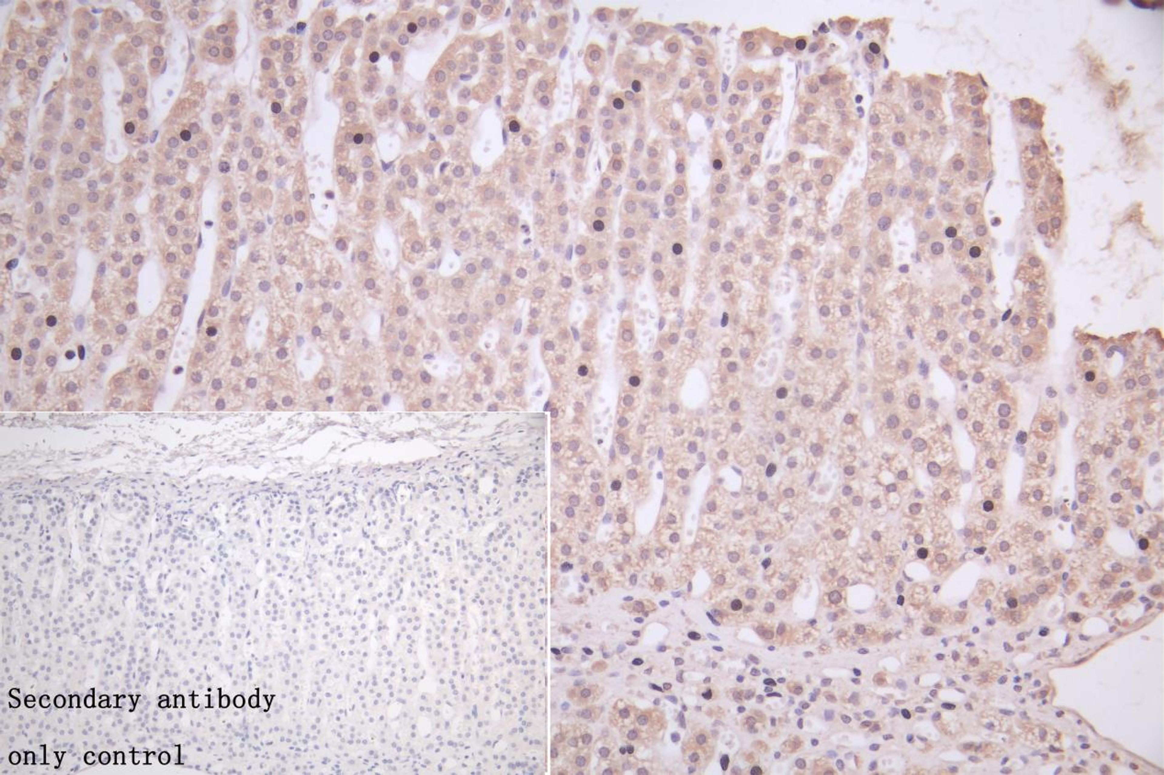 IHC image of CSB-PA011018LA01HU diluted at 1:50 and staining in paraffin-embedded human adrenal gland tissue performed on a Leica BondTM system. After dewaxing and hydration, antigen retrieval was mediated by high pressure in a citrate buffer (pH 6.0). Section was blocked with 10% normal goat serum 30min at RT. Then primary antibody (1% BSA) was incubated at 4°C overnight. The primary is detected by a Goat anti-rabbit polymer IgG labeled by HRP and visualized using 0.05% DAB.Secondary antibody only control: uses 1% BSA instead of primary antibody.