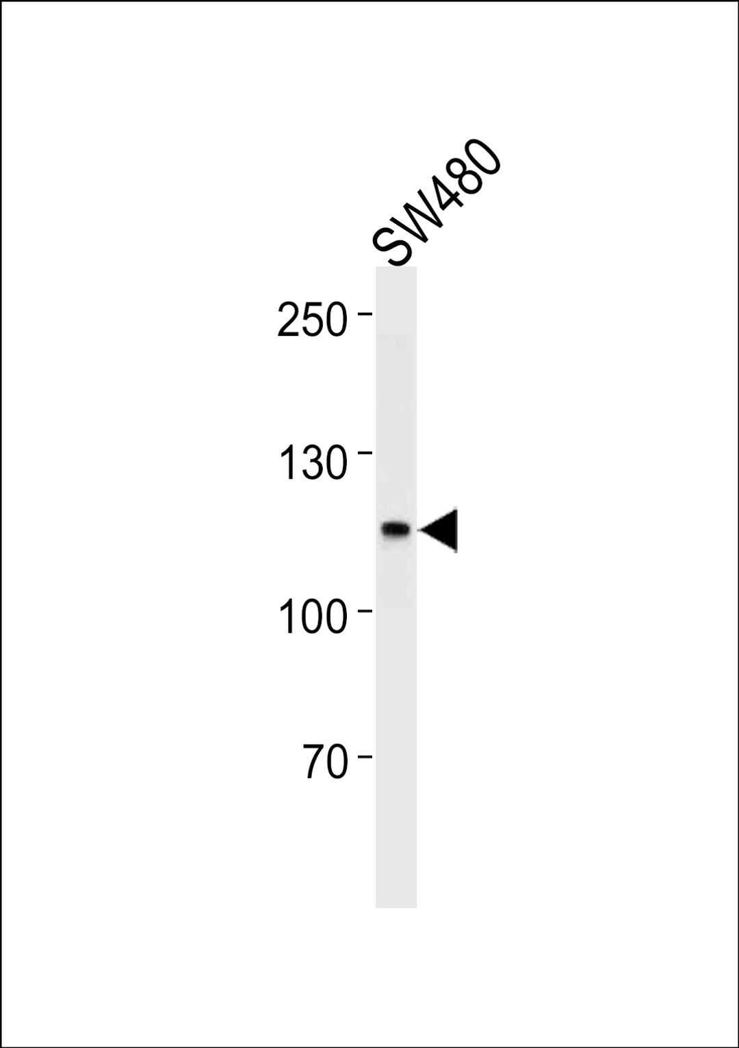 Western blot analysis in SW480,U251 cell line lysates (35ug/lane).