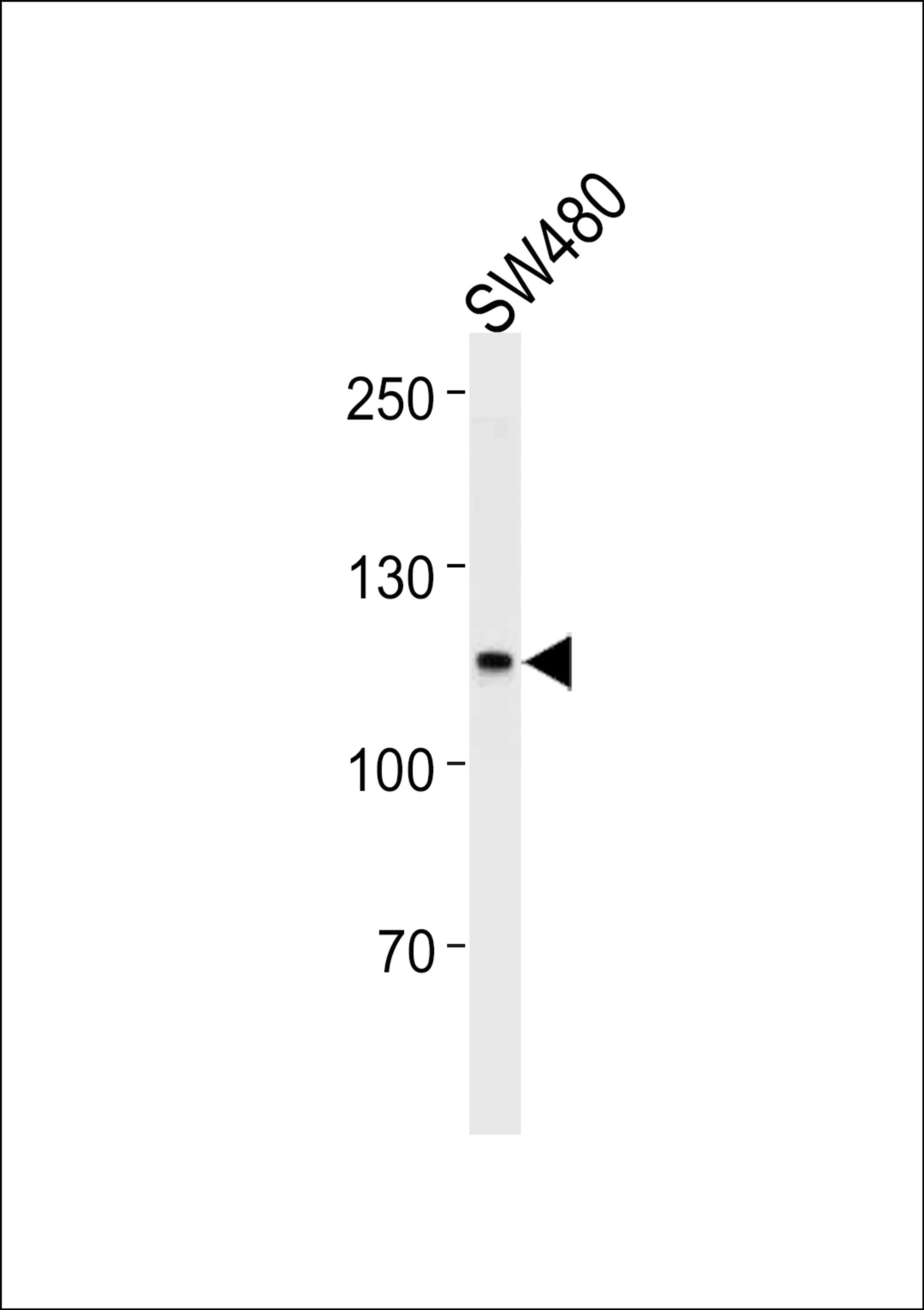 Western blot analysis in SW480,U251 cell line lysates (35ug/lane).