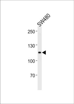 Western blot analysis in SW480,U251 cell line lysates (35ug/lane).