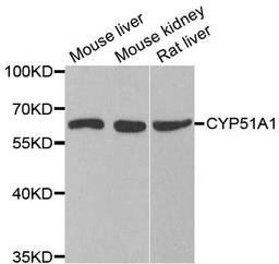 Western blot analysis of extracts of various cell lines using CYP51A1 antibody