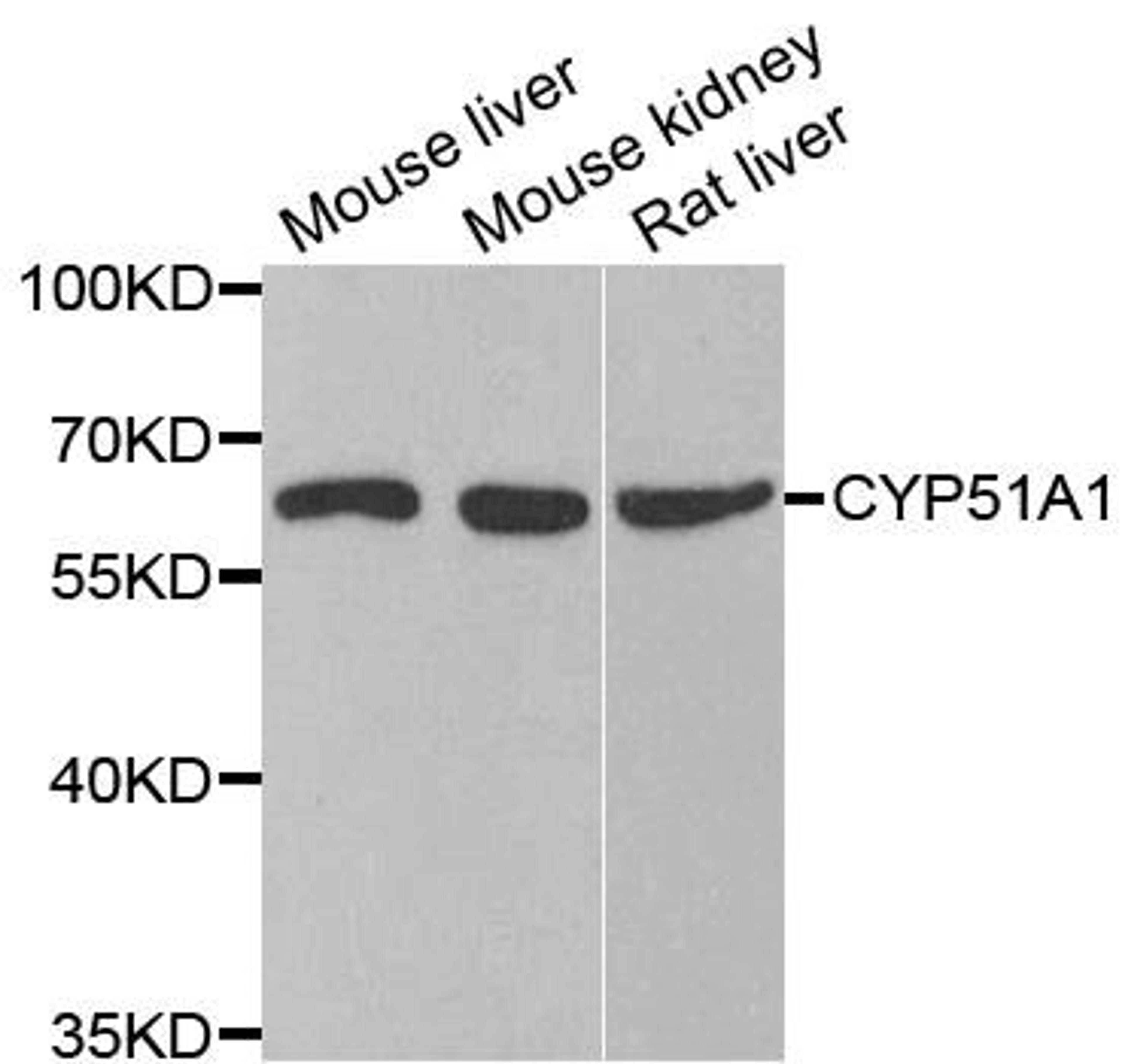 Western blot analysis of extracts of various cell lines using CYP51A1 antibody