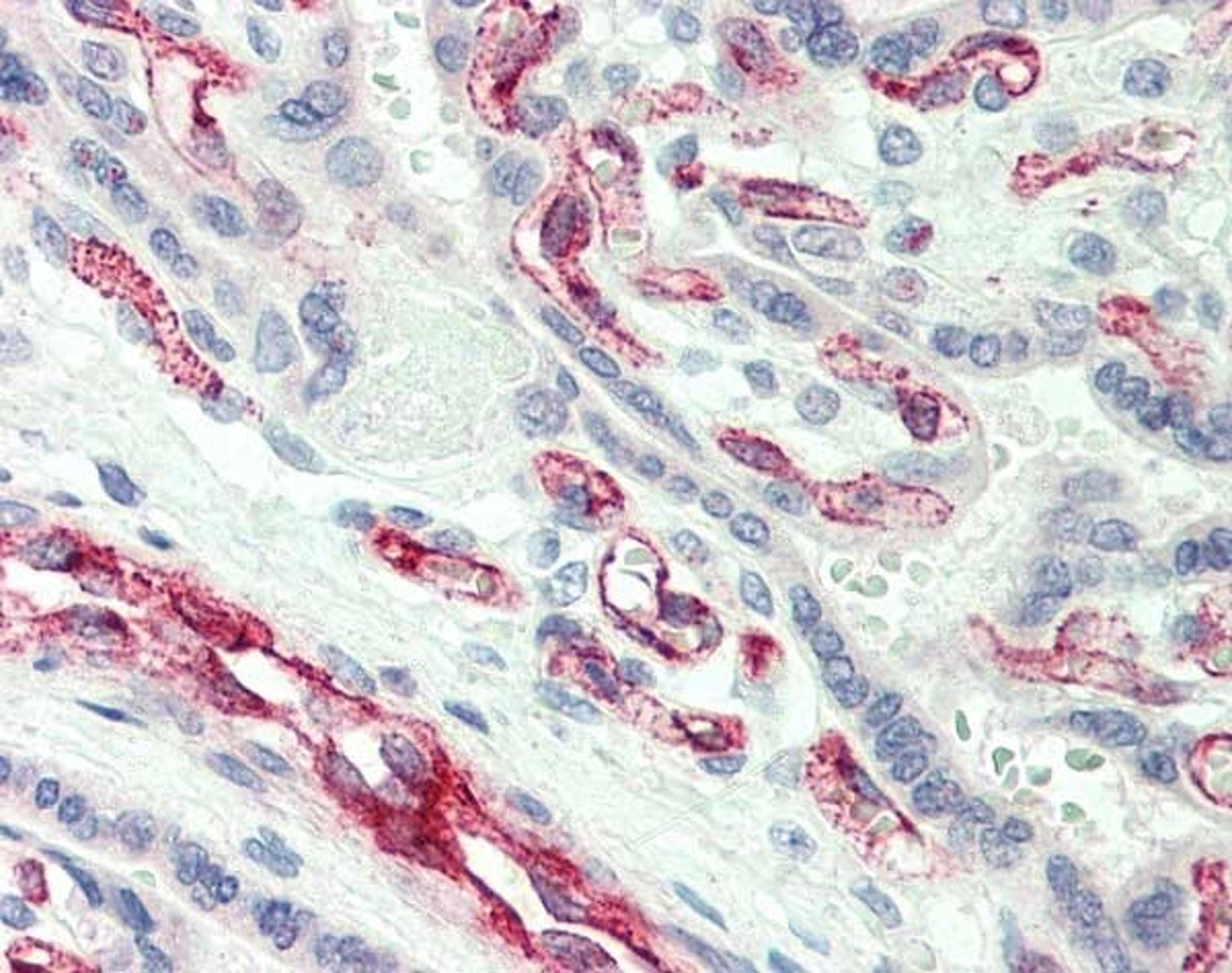 Staining of formalin fixed, paraffin embedded human placenta with Rabbit anti Human caspase-2