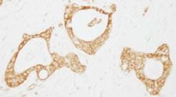 Detection of human USP3 by immunohistochemistry.