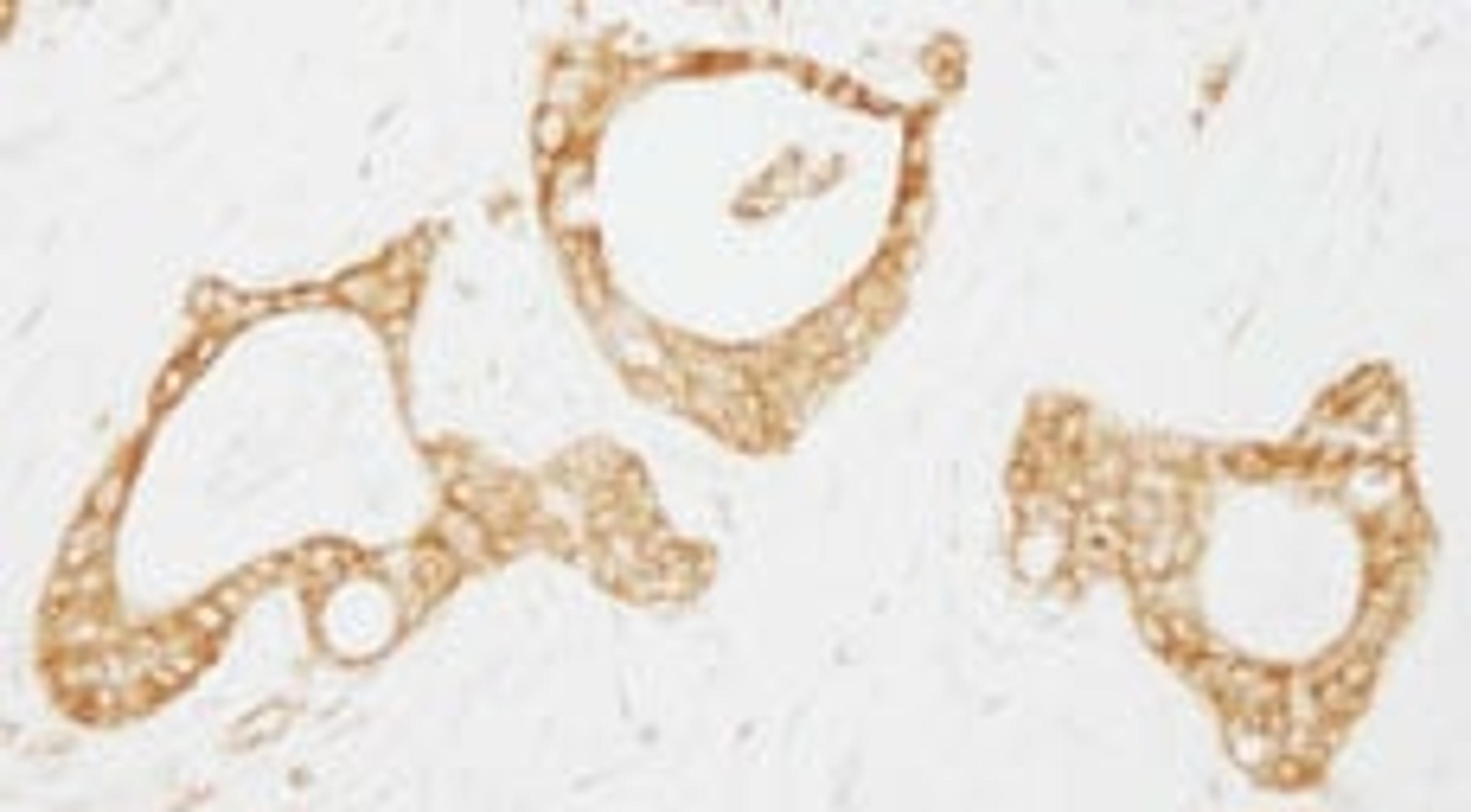 Detection of human USP3 by immunohistochemistry.