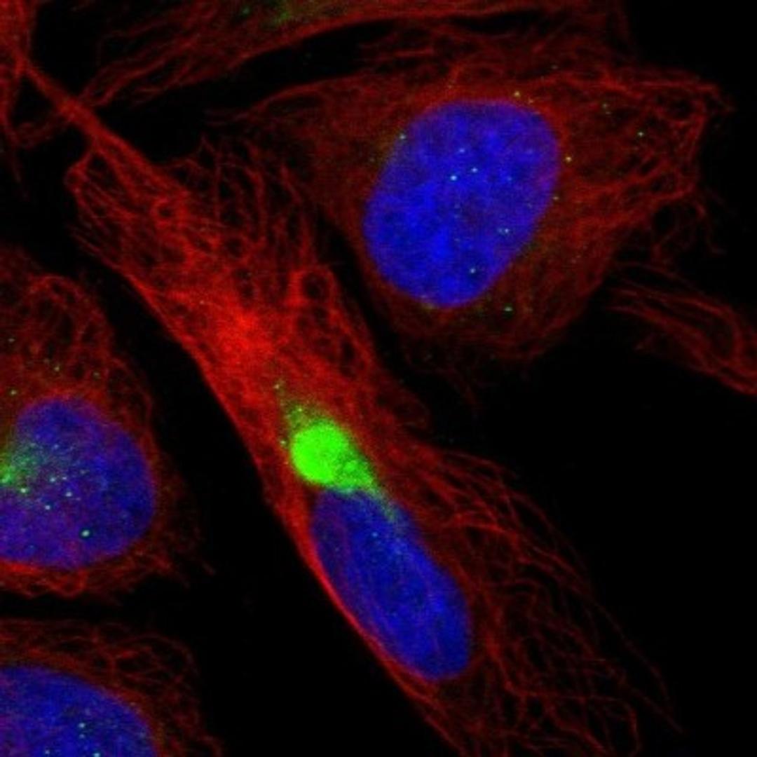 Immunocytochemistry/Immunofluorescence: Methionyl tRNA synthetase 2 Antibody [NBP1-92106] - Staining of human cell line U-2 OS shows positivity in cytoskeleton (intermediate filaments) & aggresome.