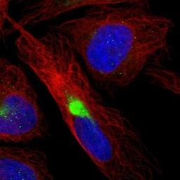 Immunocytochemistry/Immunofluorescence: Methionyl tRNA synthetase 2 Antibody [NBP1-92106] - Staining of human cell line U-2 OS shows positivity in cytoskeleton (intermediate filaments) & aggresome.