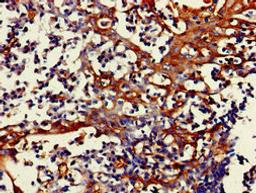 Immunohistochemistry of paraffin-embedded human tonsil tissue using CSB-PA008856LA01HU at dilution of 1:100