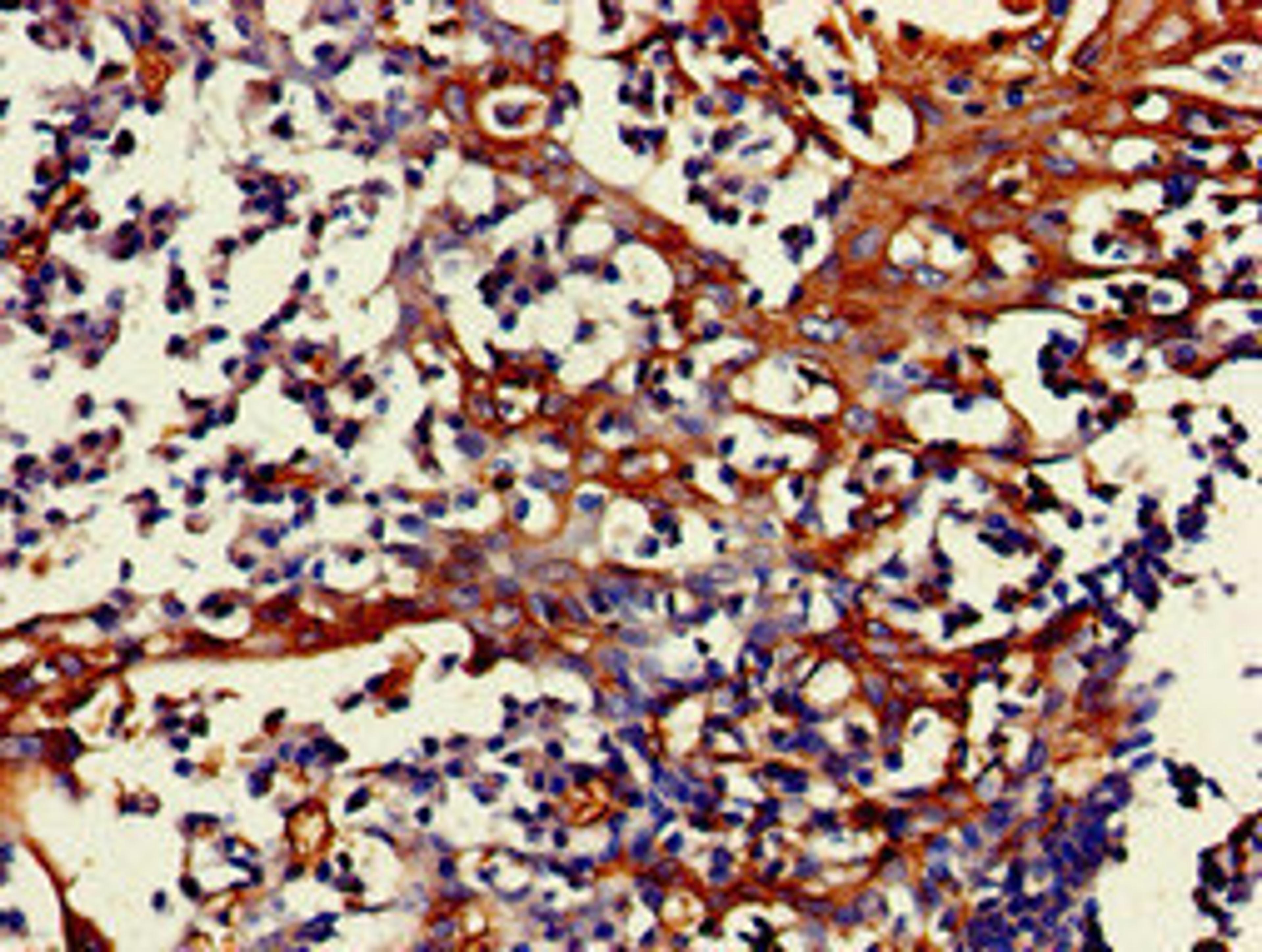Immunohistochemistry of paraffin-embedded human tonsil tissue using CSB-PA008856LA01HU at dilution of 1:100