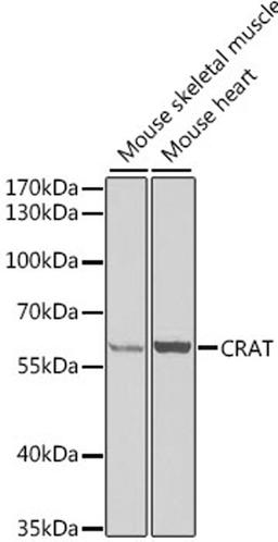 Western blot - CRAT antibody (A6365)