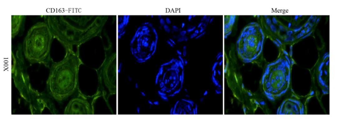 Immunofluorescence image of mouse skin tissue using anti-CD163 (dilution at 1:100)