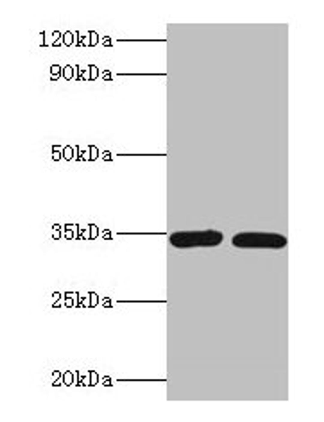 Western blot. All lanes: CASP7 antibody at 2µg/ml. Lane 1: A549 whole cell lysate. Lane 2: HGC-27 whole cell lysate. Secondary. Goat polyclonal to rabbit IgG at 1/10000 dilution. Predicted band size: 35, 29, 38, 32 kDa. Observed band size: 35 kDa
