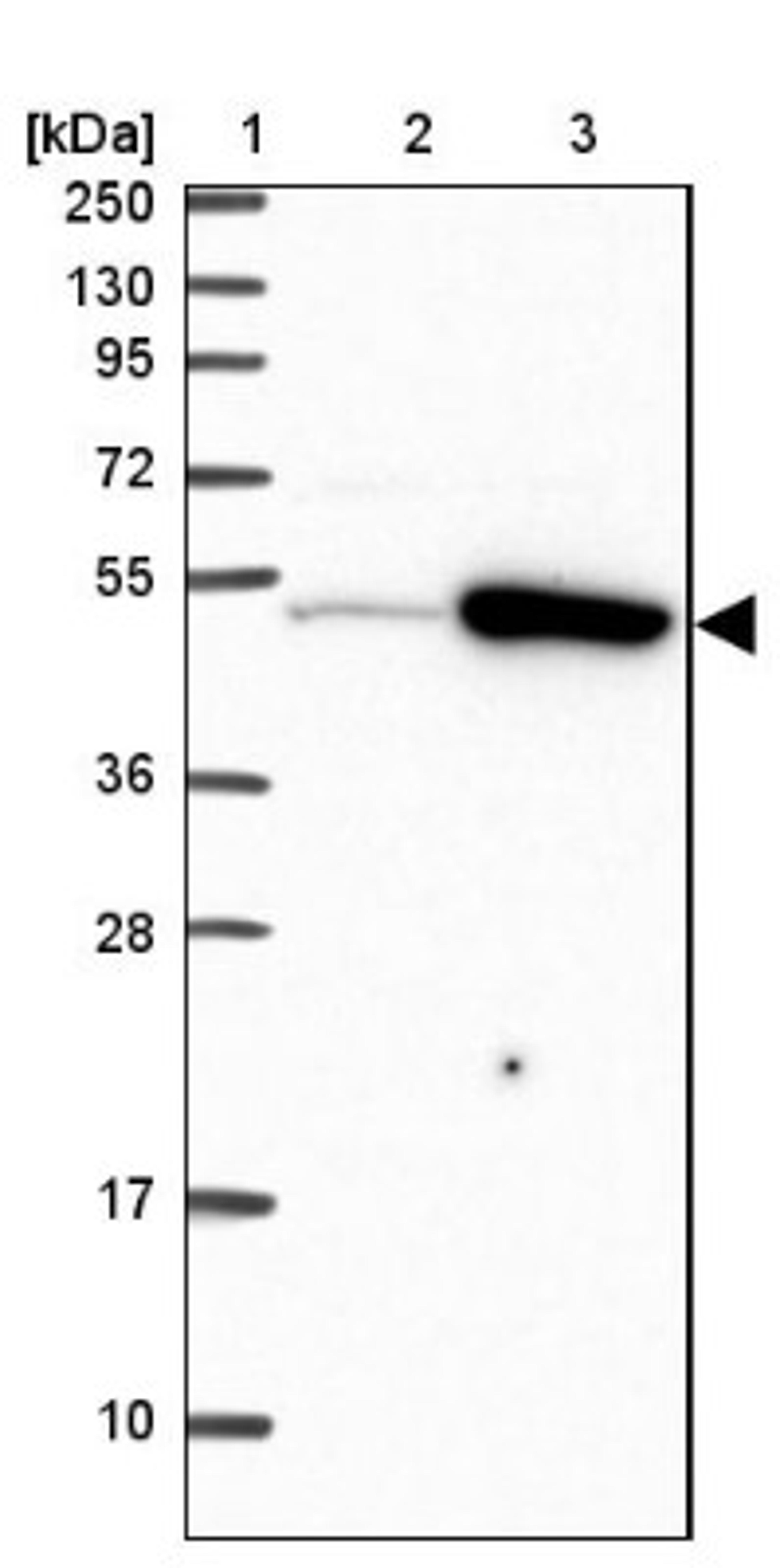 Western Blot: TRIP6 Antibody [NBP2-33667] - Lane 1: Marker [kDa] 250, 130, 95, 72, 55, 36, 28, 17, 10<br/>Lane 2: Human cell line RT-4<br/>Lane 3: Human cell line U-251MG sp