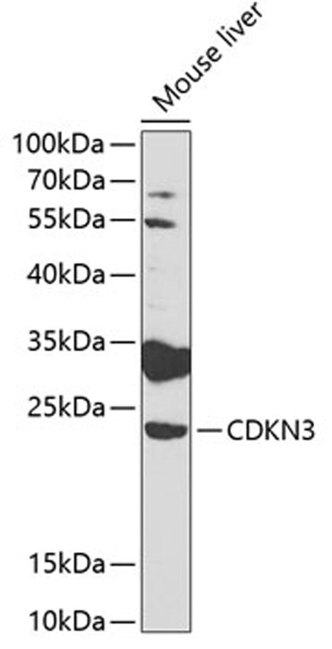 Western blot - CDKN3 antibody (A2061)