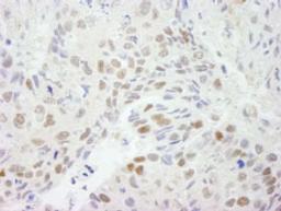 Detection of human HDAC3 by immunohistochemistry.