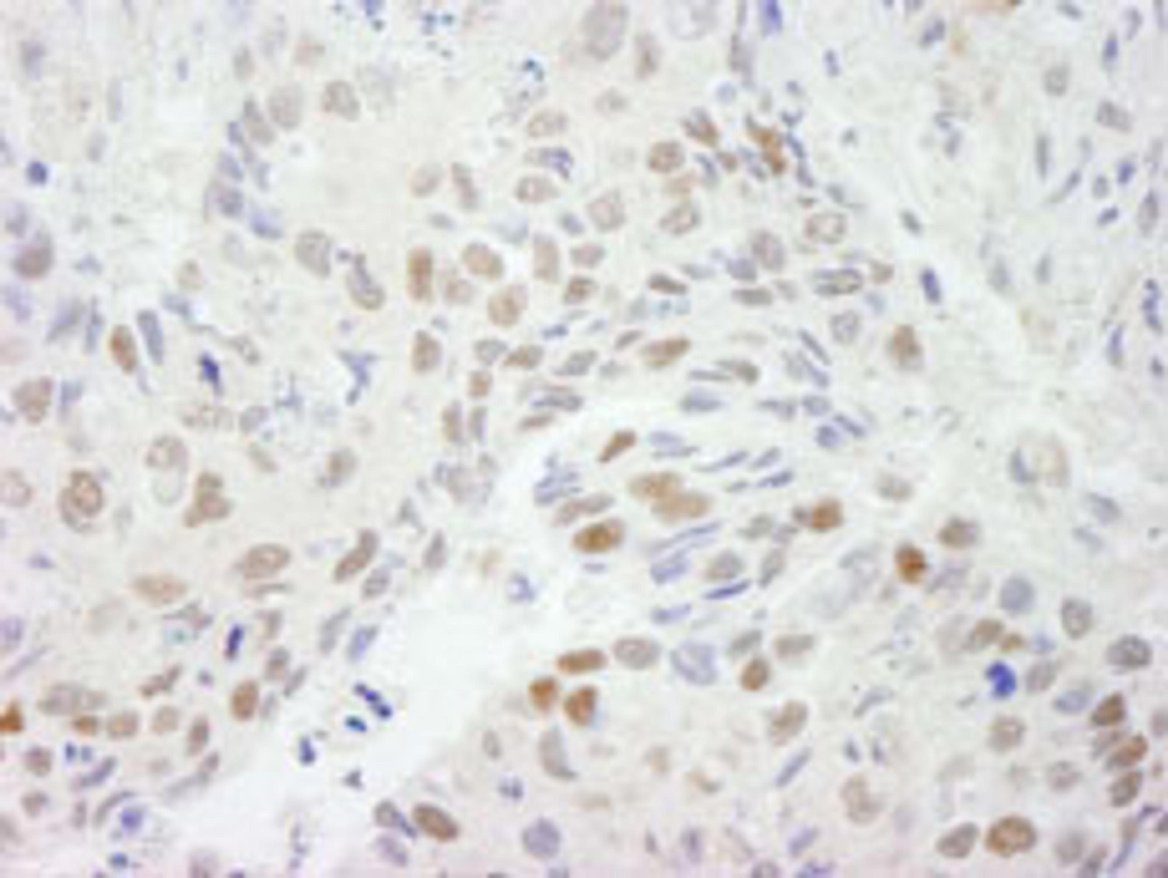 Detection of human HDAC3 by immunohistochemistry.