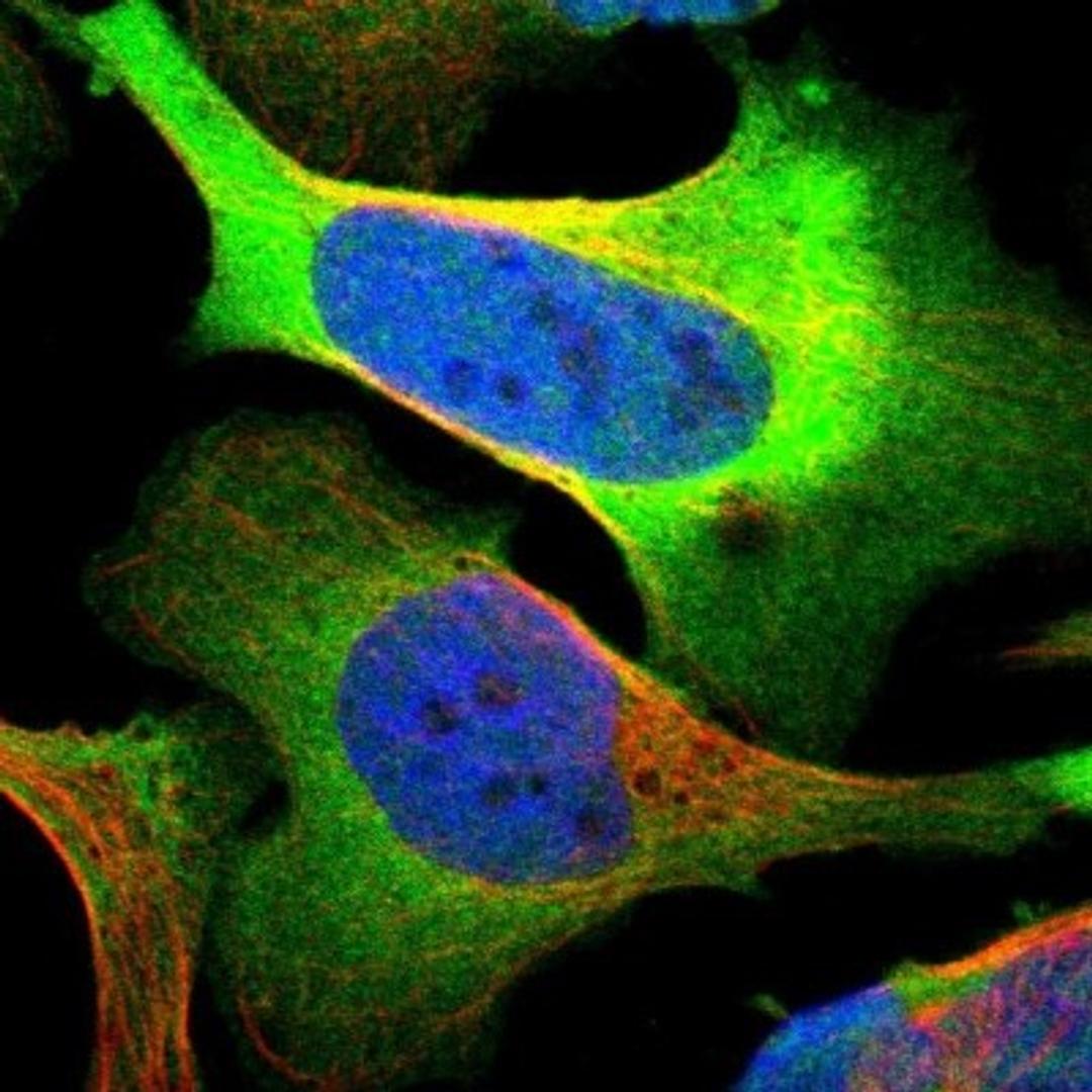 Immunocytochemistry/Immunofluorescence: PHGDH Antibody [NBP1-87311] - Staining of human cell line U-2 OS shows positivity in plasma membrane & cytoplasm.