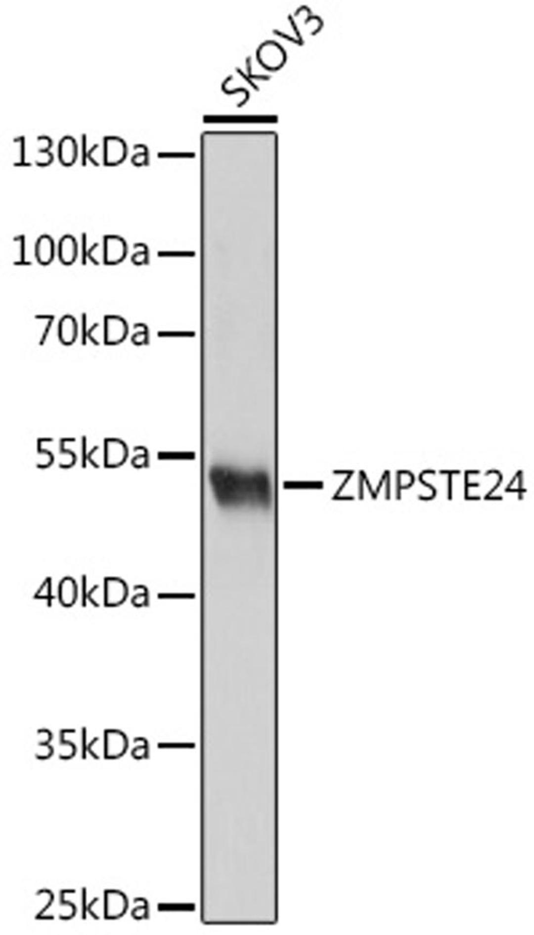 Western blot - ZMPSTE24 antibody (A18593)