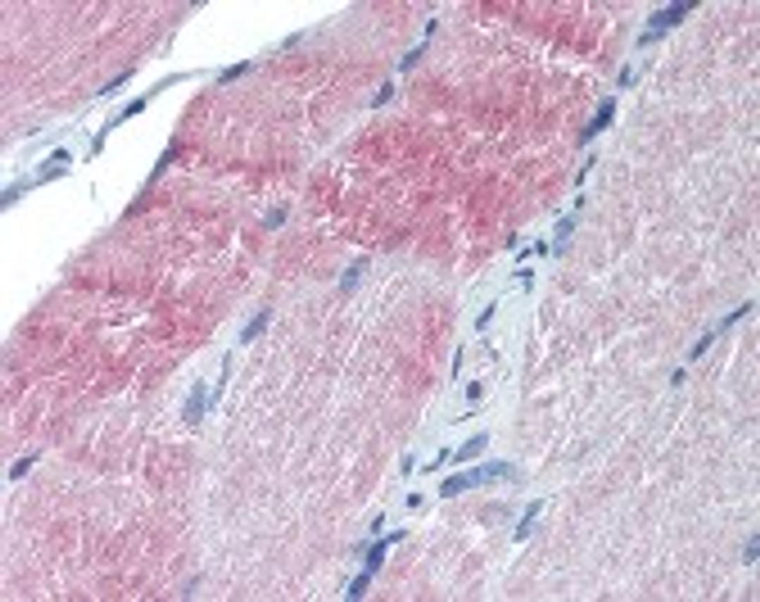 Immunohistochemistry staining of Caspase-7 in skeletal muscle tissue using Caspase-7 monoclonal Antibody.