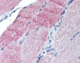 Immunohistochemistry staining of Caspase-7 in skeletal muscle tissue using Caspase-7 monoclonal Antibody.