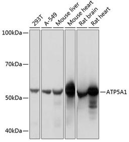 Western blot - ATP5A1 Rabbit mAb (A11217)