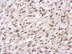 Immunohistochemistry-Paraffin: HDAC11 Antibody [NBP2-16789] - Immunohistochemical analysis of paraffin-embedded C2C12 xenograft, using antibody at 1:500 dilution.