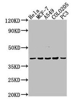 Western Blot. Positive WB detected in: Hela whole cell lysate, MCF-7 whole cell lysate, A549 whole cell lysate, COLO205 whole cell lysate, PC-3 whole cell lysate. All lanes: LPAR2 antibody at 1:2000. Secondary. Goat polyclonal to rabbit IgG at 1/50000 dilution. Predicted band size: 40 kDa. Observed band size: 40 kDa. 