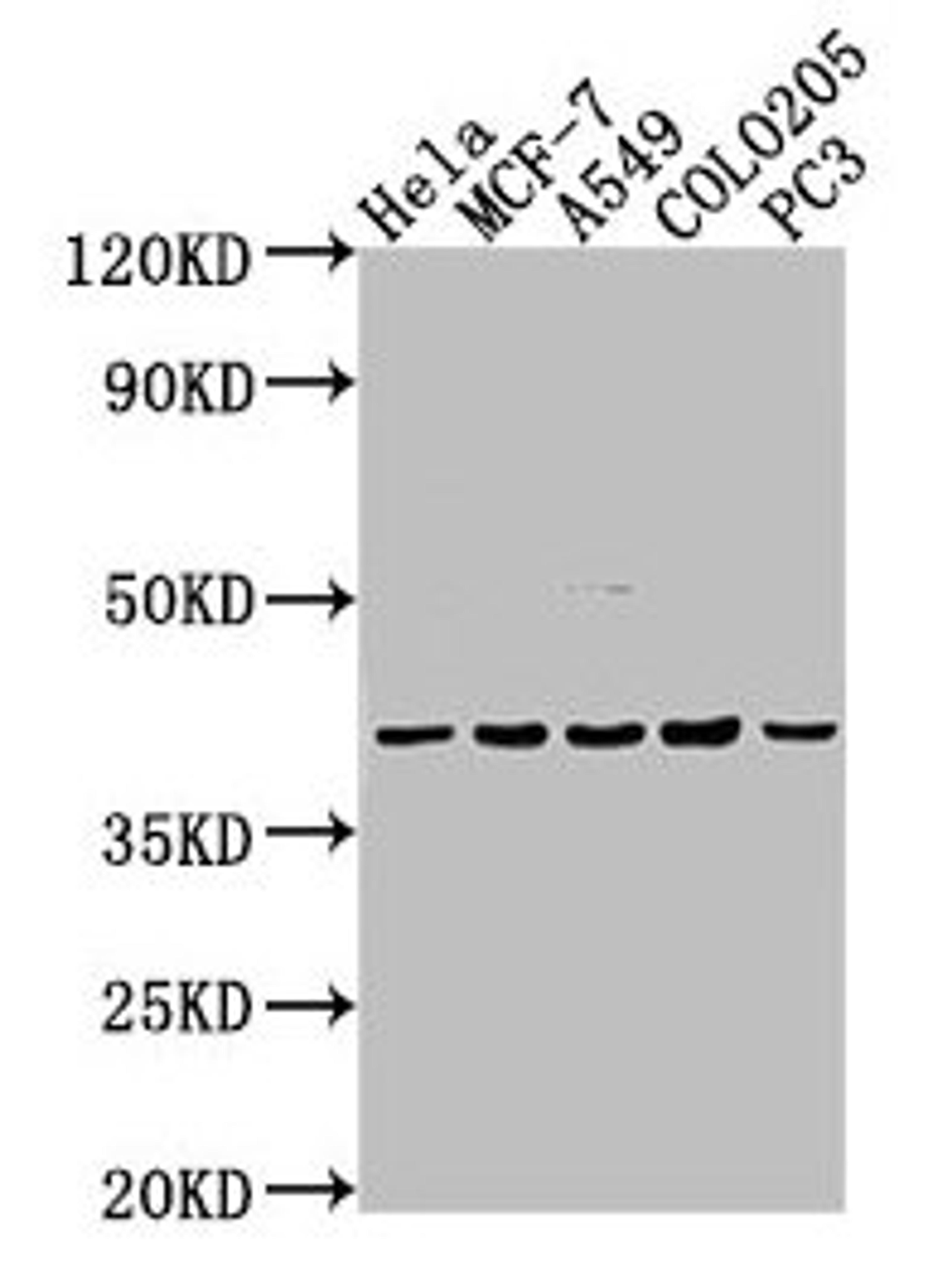 Western Blot. Positive WB detected in: Hela whole cell lysate, MCF-7 whole cell lysate, A549 whole cell lysate, COLO205 whole cell lysate, PC-3 whole cell lysate. All lanes: LPAR2 antibody at 1:2000. Secondary. Goat polyclonal to rabbit IgG at 1/50000 dilution. Predicted band size: 40 kDa. Observed band size: 40 kDa. 