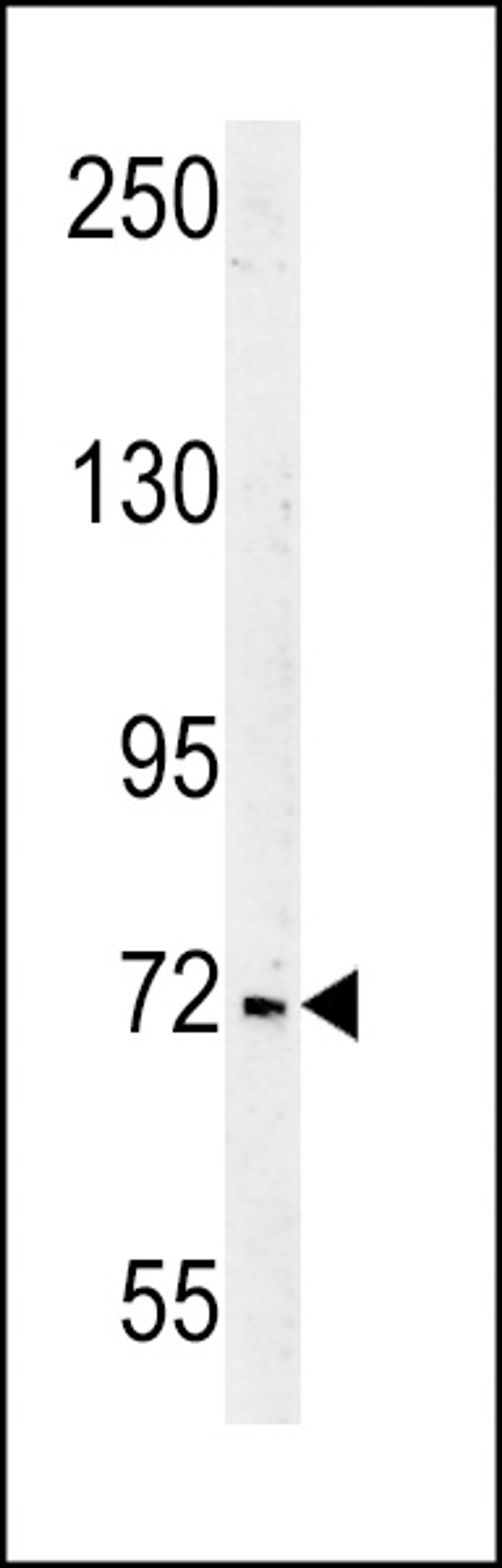 Western blot analysis in Jurkat cell line lysates (35ug/lane).