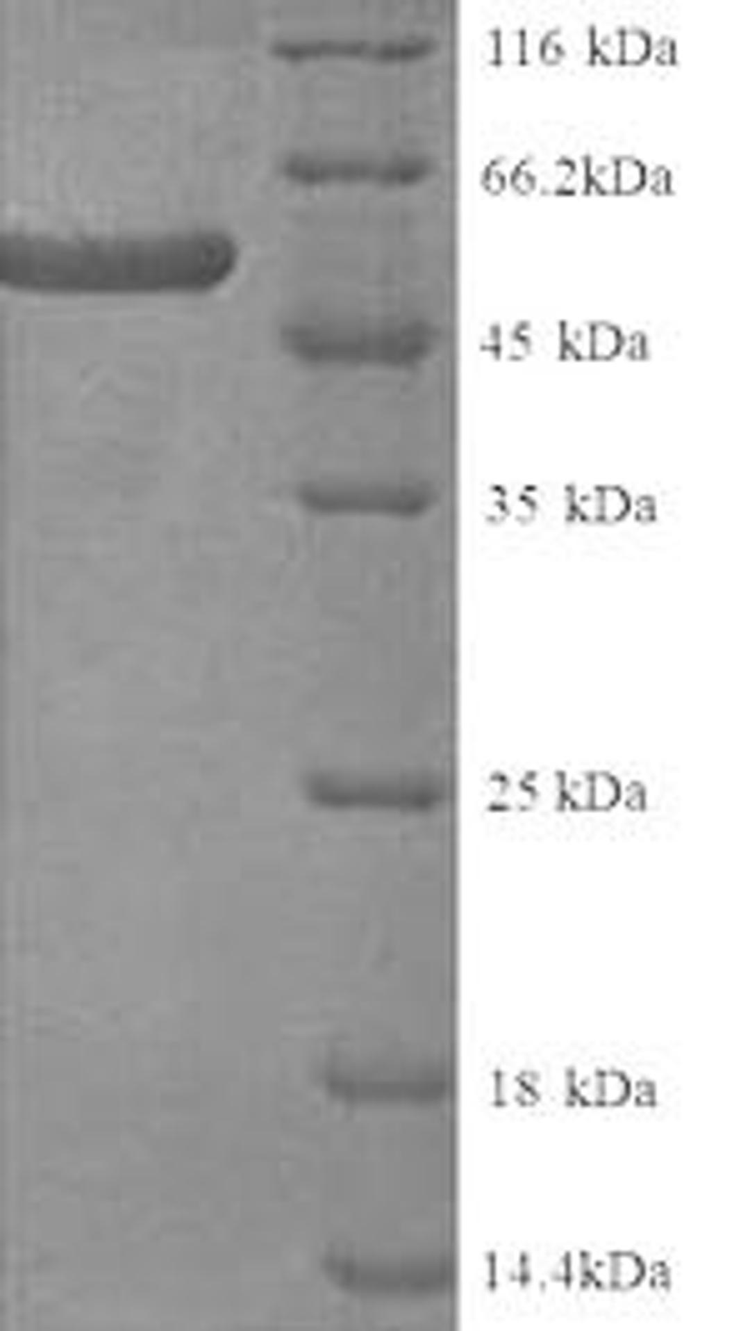 (Tris-Glycine gel) Discontinuous SDS-PAGE (reduced) with 5% enrichment gel and 15% separation gel.