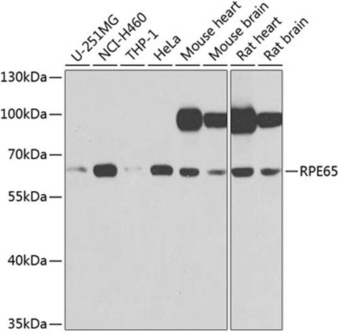 Western blot - RPE65 antibody (A9841)