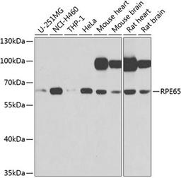 Western blot - RPE65 antibody (A9841)