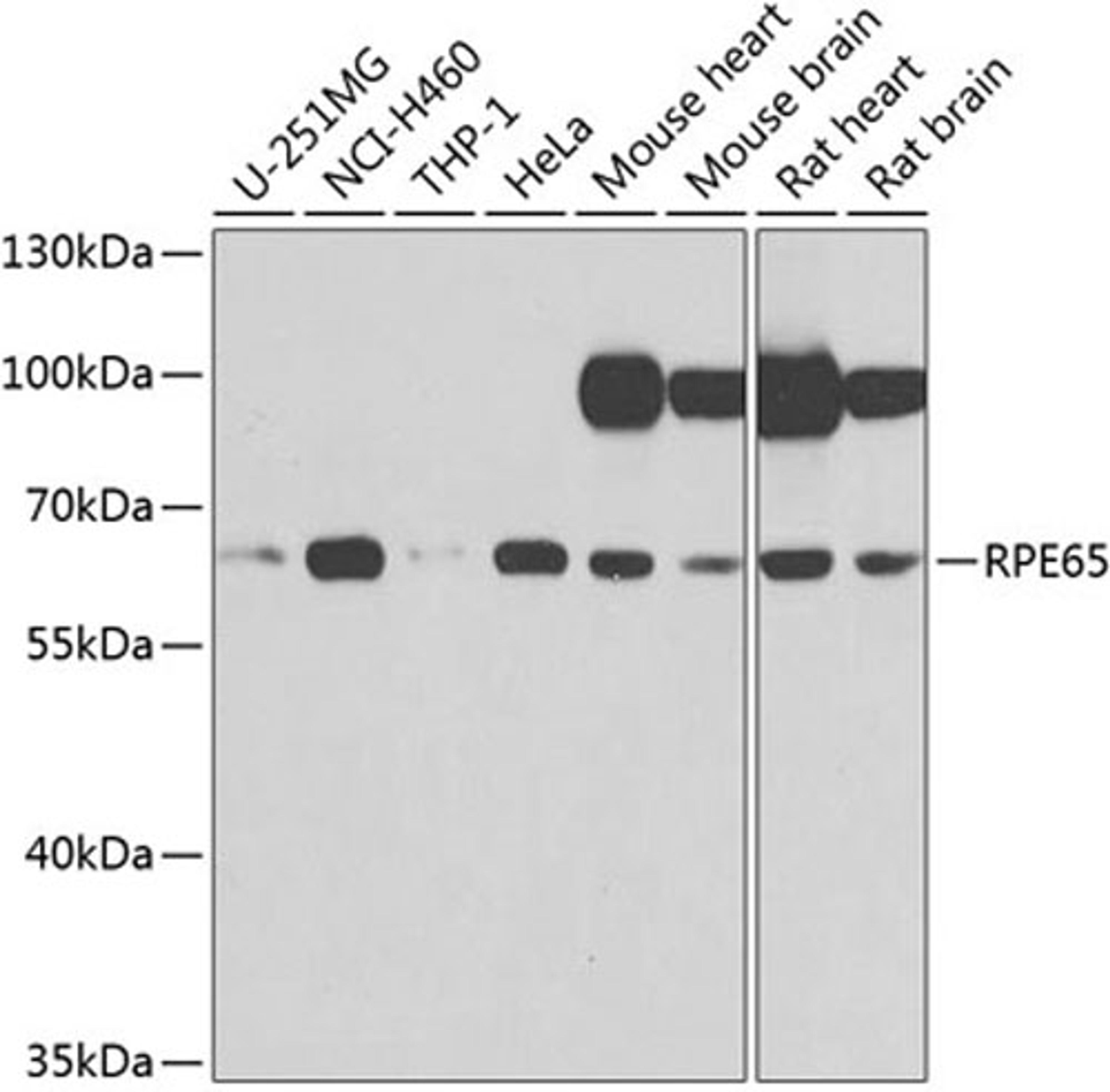 Western blot - RPE65 antibody (A9841)