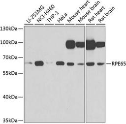 Western blot - RPE65 antibody (A9841)