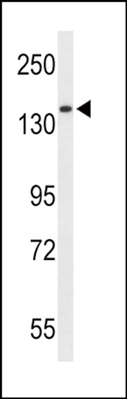 Western blot analysis of RECK Antibody in HepG2 cell line lysates (35ug/lane)