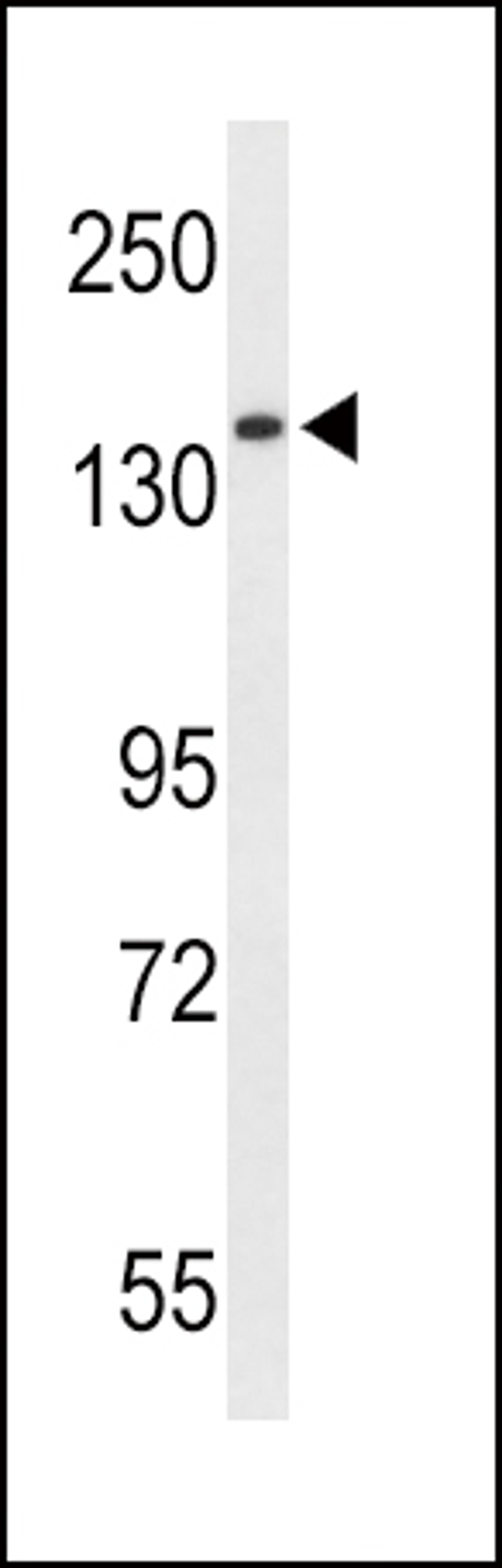 Western blot analysis of RECK Antibody in HepG2 cell line lysates (35ug/lane)