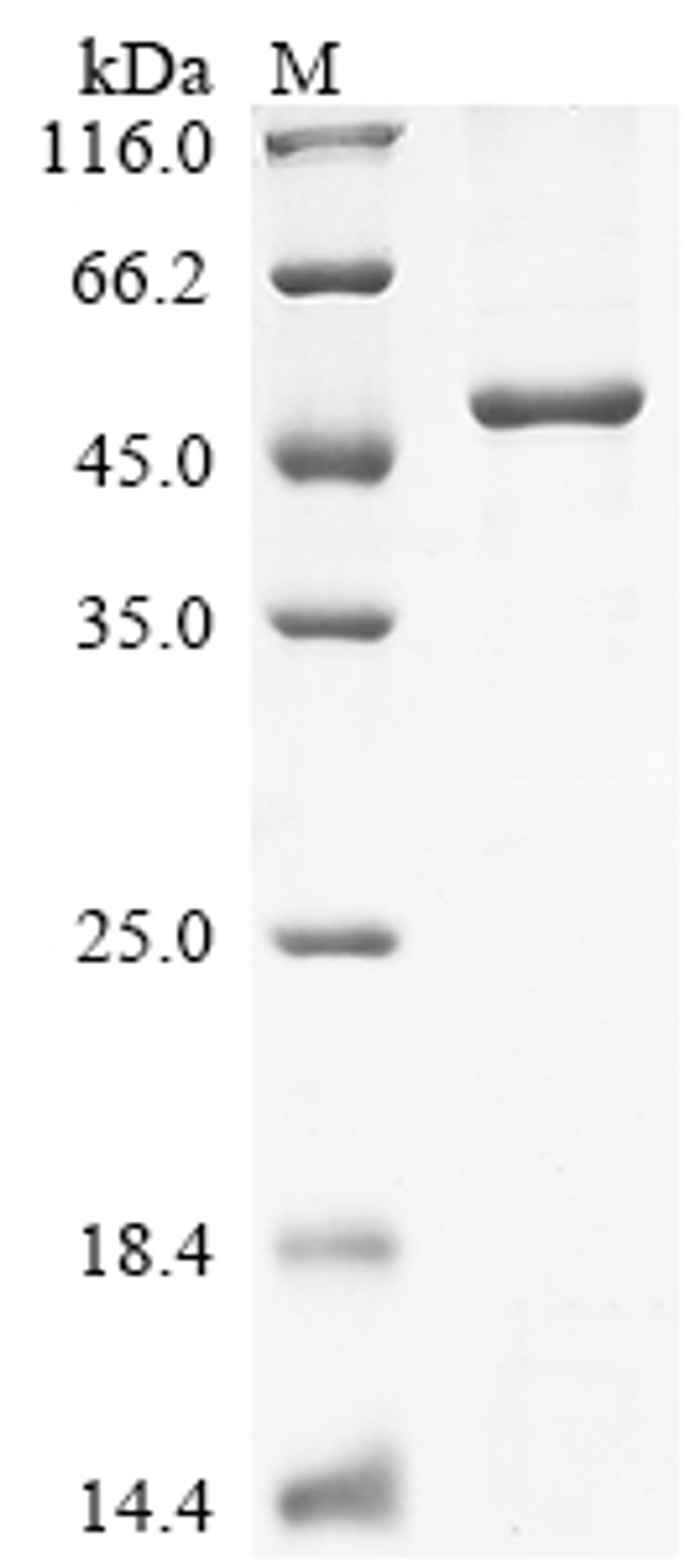 (Tris-Glycine gel) Discontinuous SDS-PAGE (reduced) with 5% enrichment gel and 15% separation gel.