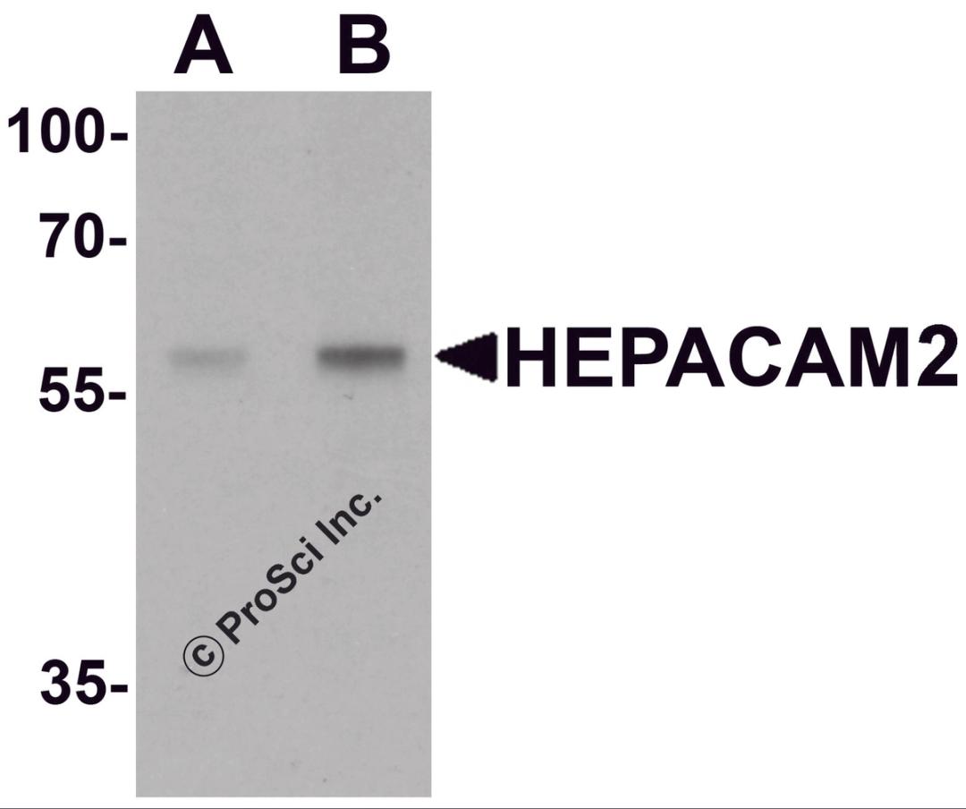 Western blot analysis of HEPACAM2 in mouse brain tissue lysate with HEPACAM2 antibody at (A) 0.5 &#956;g/mL and (B) 1 &#956;g/mL.