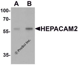 Western blot analysis of HEPACAM2 in mouse brain tissue lysate with HEPACAM2 antibody at (A) 0.5 μg/mL and (B) 1 μg/mL.