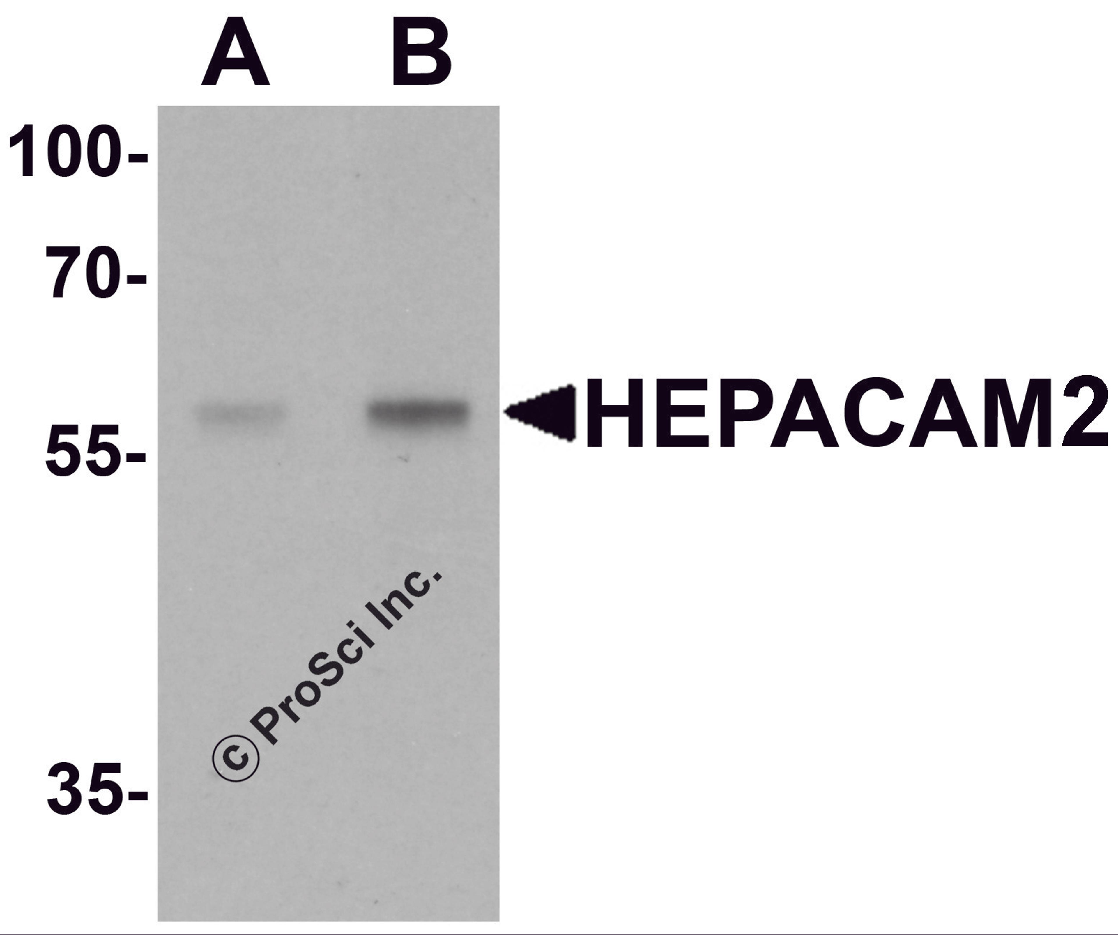 Western blot analysis of HEPACAM2 in mouse brain tissue lysate with HEPACAM2 antibody at (A) 0.5 μg/mL and (B) 1 μg/mL.