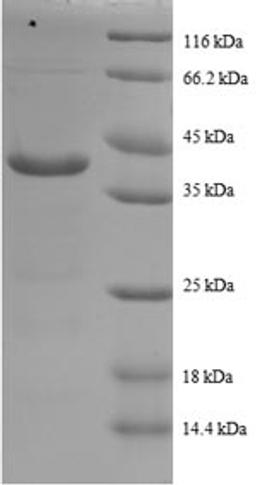 (Tris-Glycine gel) Discontinuous SDS-PAGE (reduced) with 5% enrichment gel and 15% separation gel.