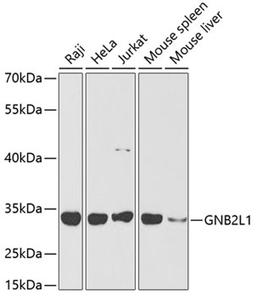 Western blot - GNB2L1 antibody (A2560)