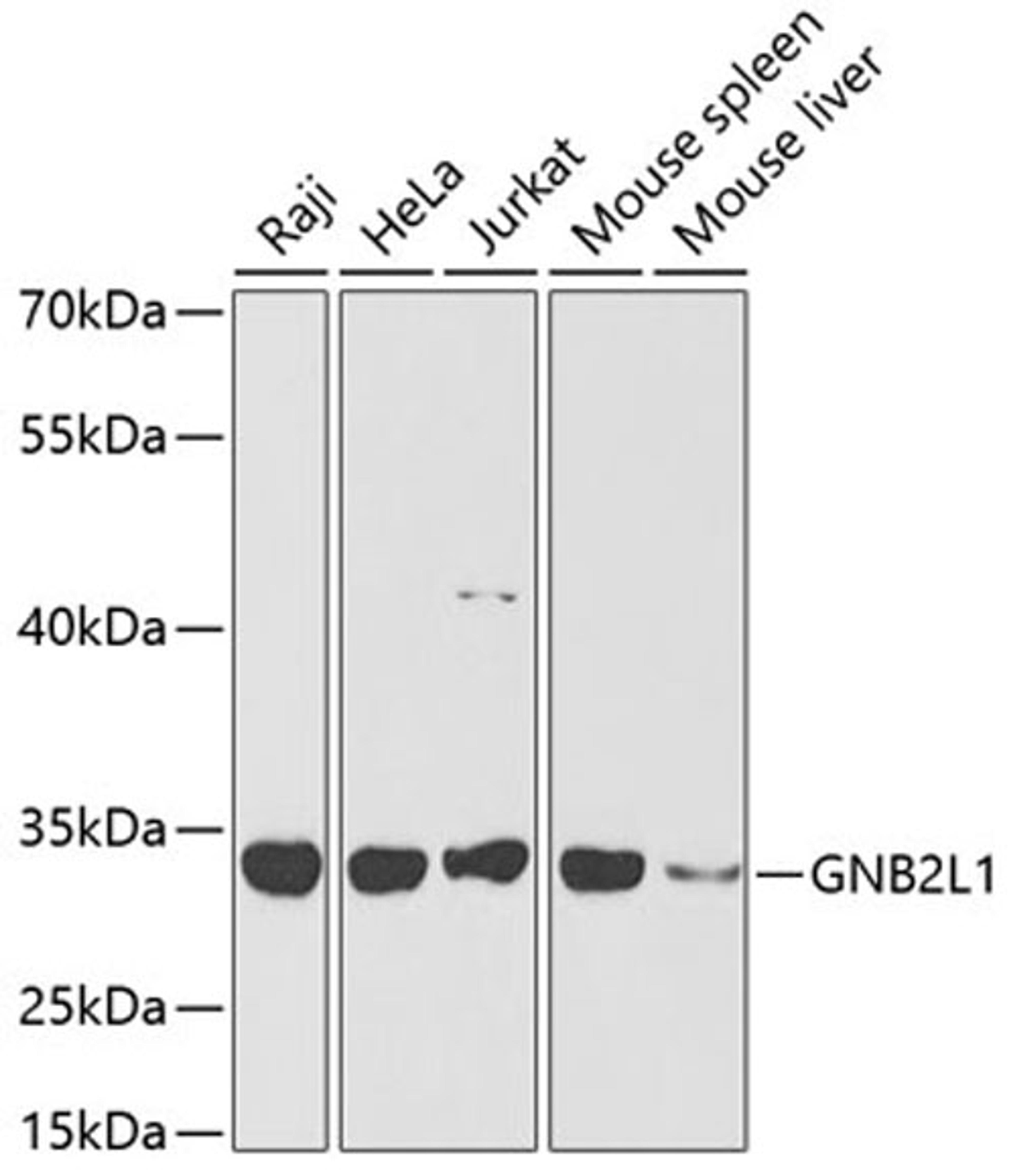 Western blot - GNB2L1 antibody (A2560)