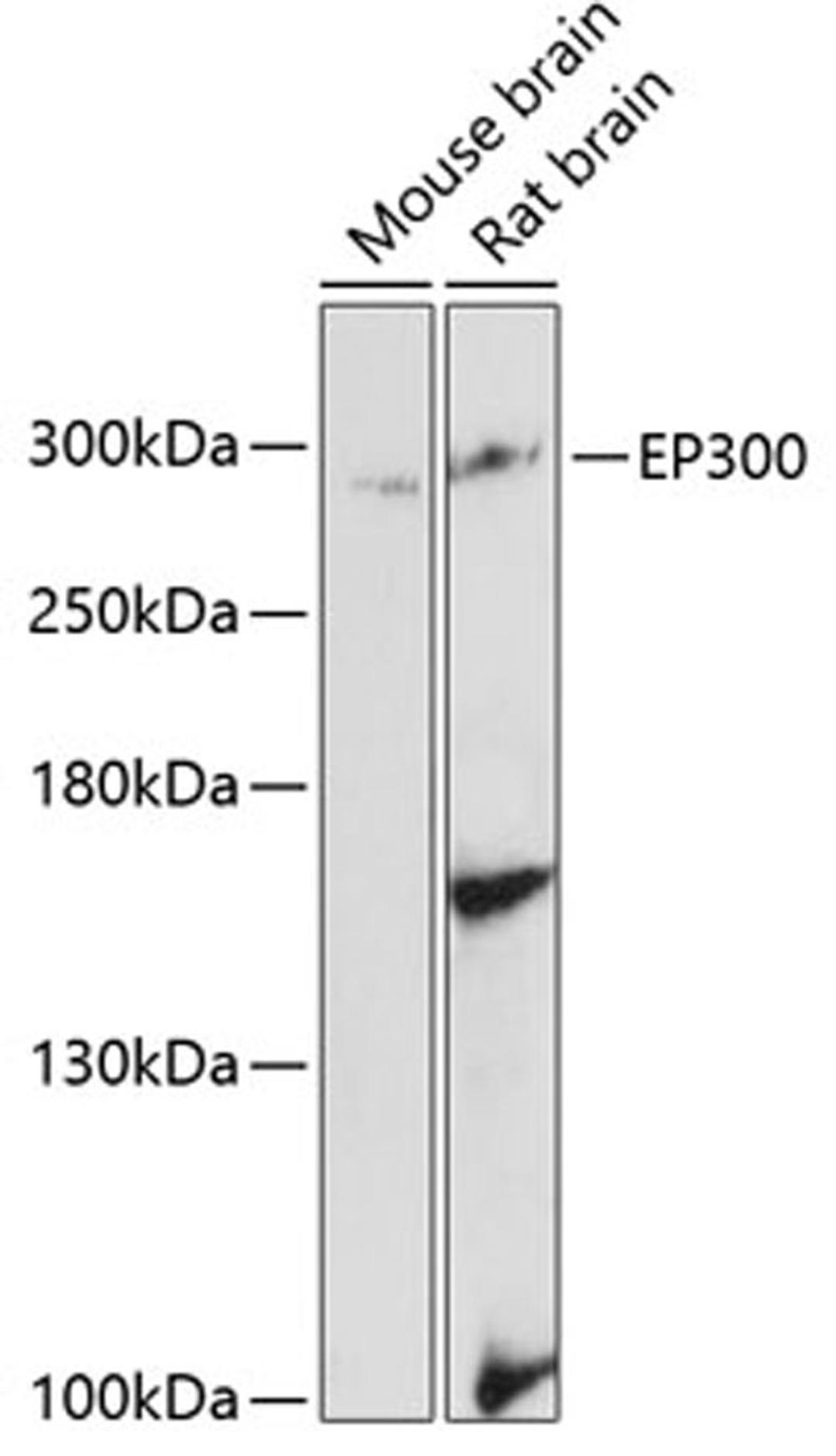 Western blot - EP300 antibody (A13016)