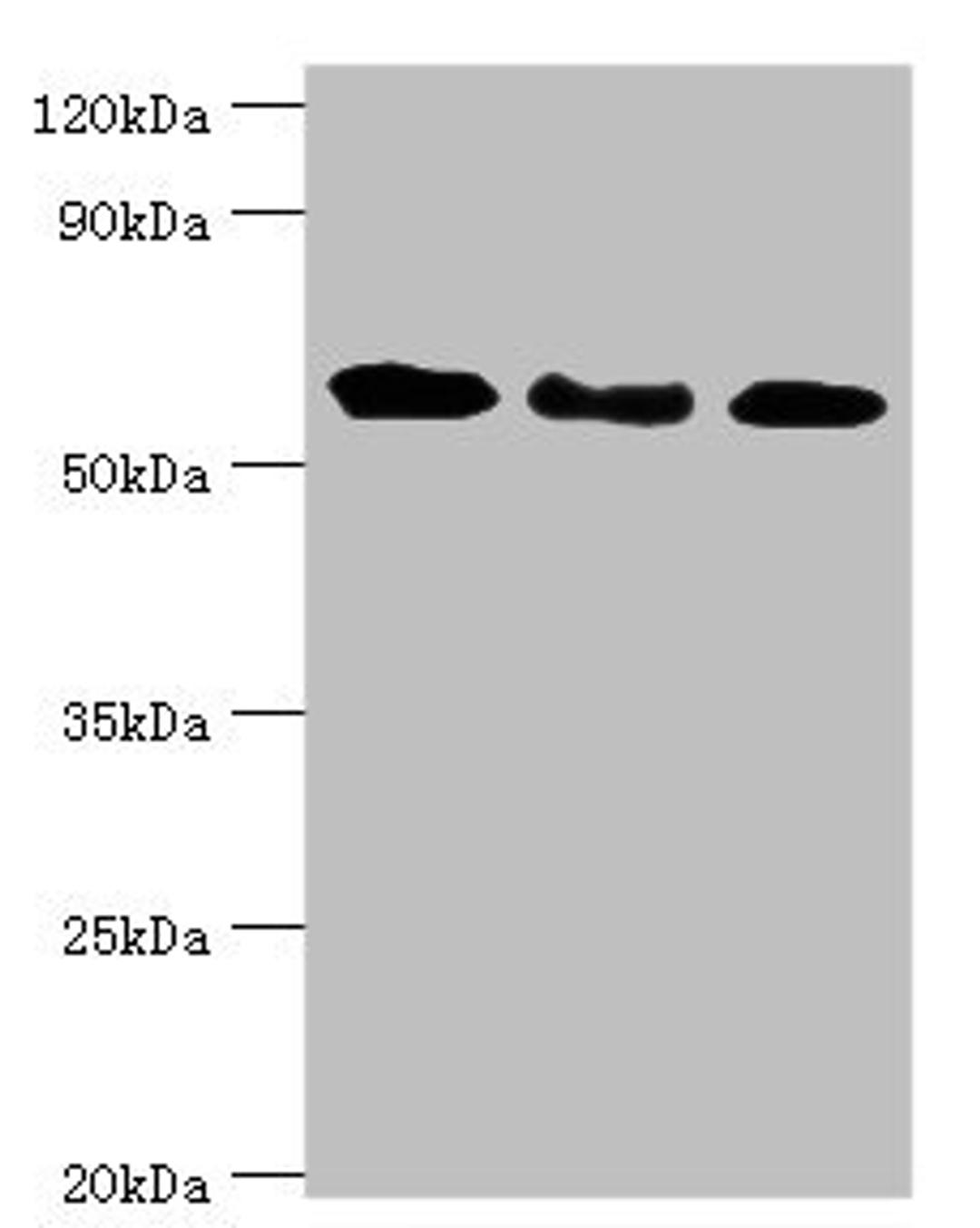 Western blot. All lanes: Interferon-induced guanylate-binding protein 1 antibody at 4ug/ml. Lane 1: MM231 whole cell lysate. Lane 2: Hela whole cell lysate. Lane 3: MGF-7 whole cell lysate. Secondary. Goat polyclonal to rabbit IgG at 1/10000 dilution. Predicted band size: 68 kDa. Observed band size: 68 kDa.