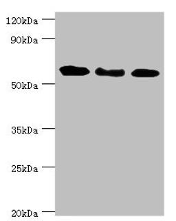 Western blot. All lanes: Interferon-induced guanylate-binding protein 1 antibody at 4ug/ml. Lane 1: MM231 whole cell lysate. Lane 2: Hela whole cell lysate. Lane 3: MGF-7 whole cell lysate. Secondary. Goat polyclonal to rabbit IgG at 1/10000 dilution. Predicted band size: 68 kDa. Observed band size: 68 kDa.