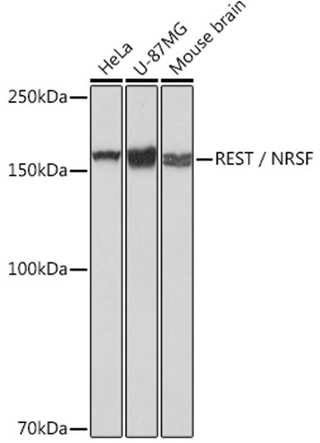 Western blot - REST / NRSF Rabbit mAb (A2415)