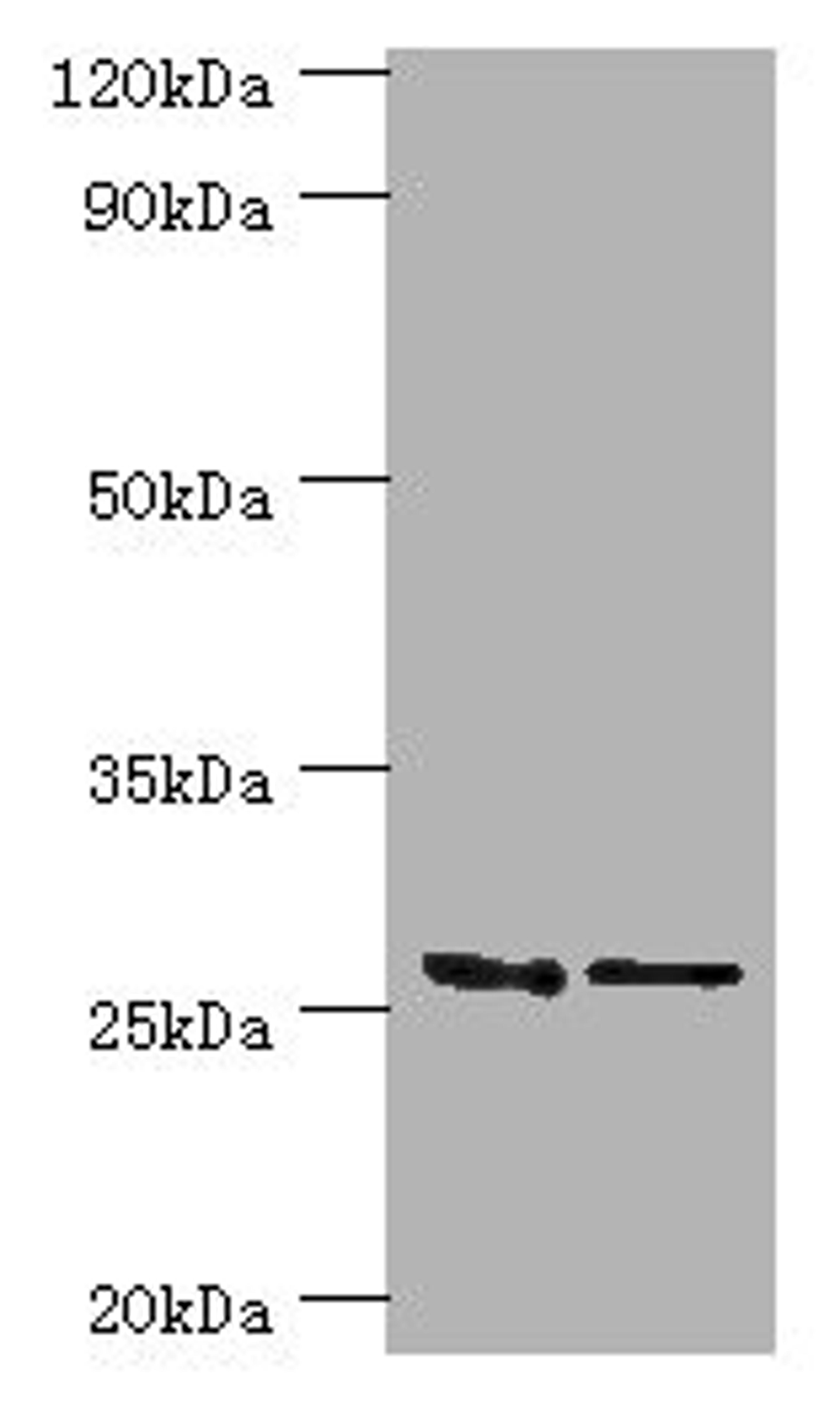 Western blot. All lanes: GSTM4 antibody at 10ug/ml. Lane 1: Rat lung tissue. Lane 2: MCF-7 whole cell lysate. Secondary. Goat polyclonal to rabbit IgG at 1/10000 dilution. Predicted band size: 26, 23, 19 kDa. Observed band size: 26 kDa.
