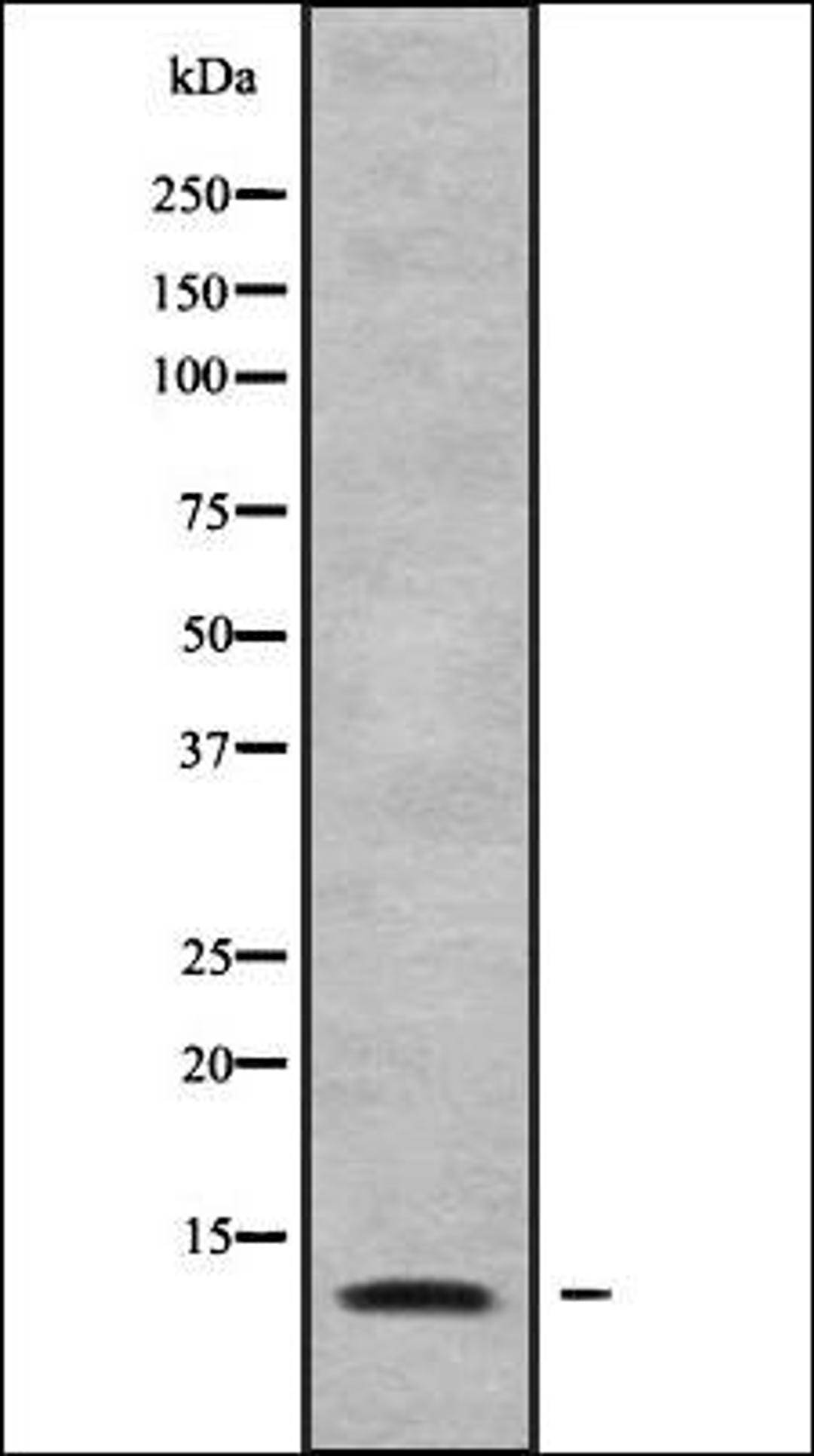 Western blot analysis of COLO205 whole cell lysates using MRPL34 antibody